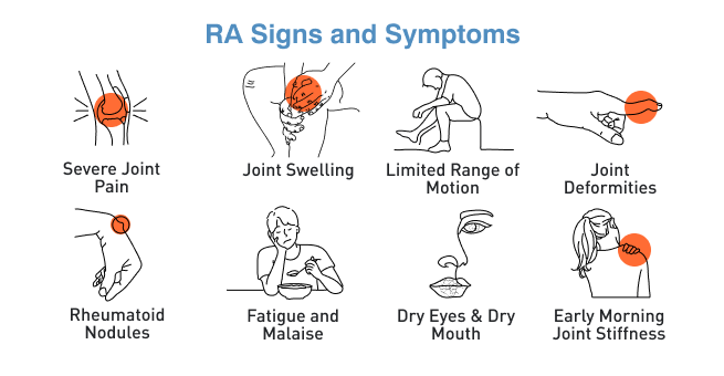 Arthritis Early Treatment Helps