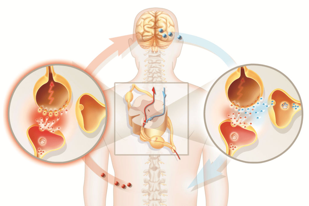 Neuropathic Pain Management