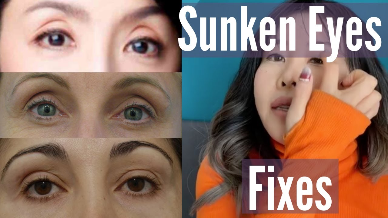 How to Fix Eye Sunken? - TheInspireSpy.com