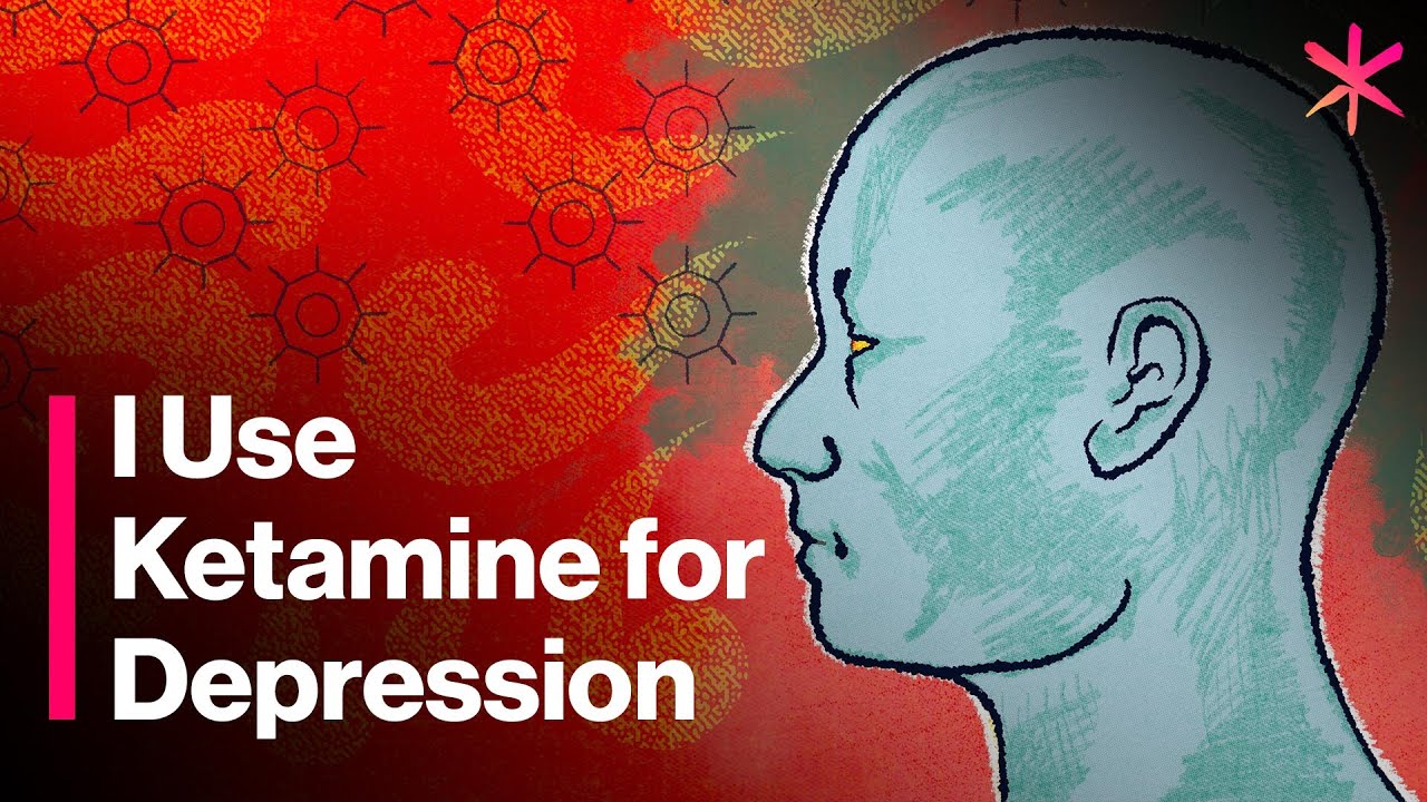 How to get ketamine therapy for depression?