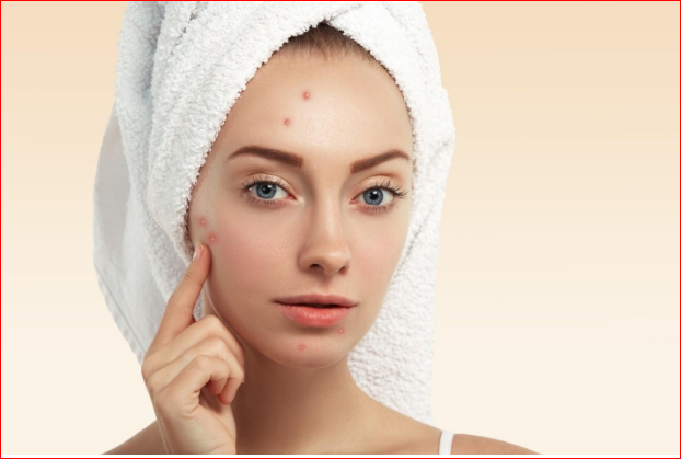 What Causes Clogged Pores? How to Prevent Breakouts