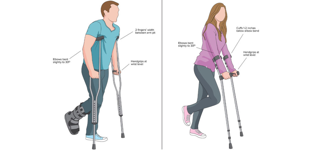 how-to-use-your-crutches-appropriately-theinspirespy