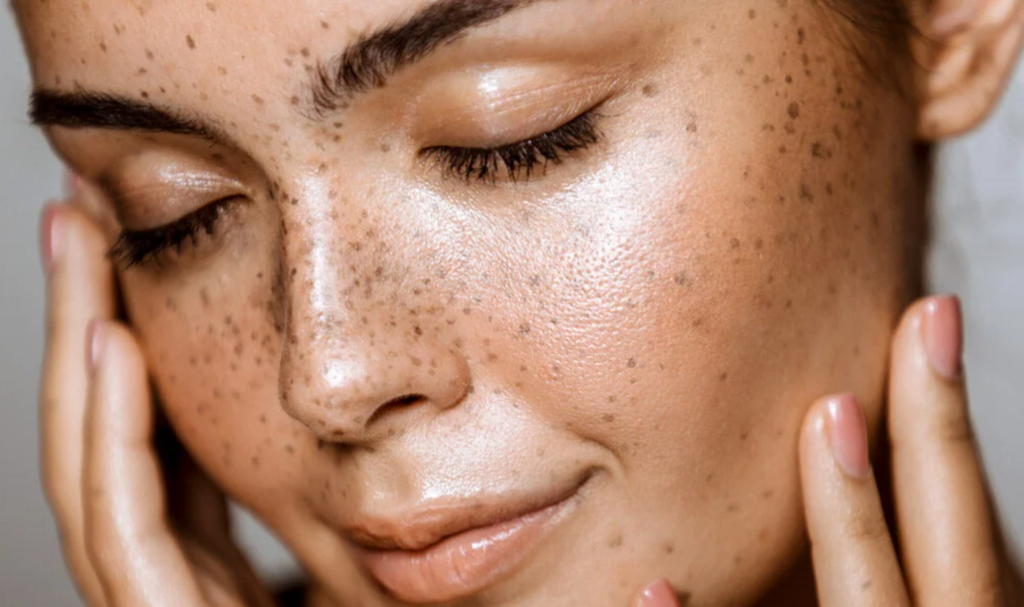 3 Important Ways to Take Care of Your Skin