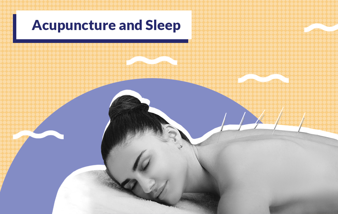 How Acupuncture Can Help You Get a Good Night's Sleep