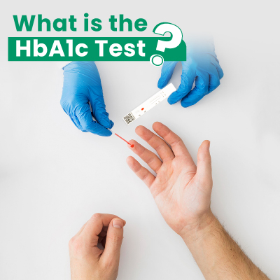 A Closer Look at HbA1c Test Prices