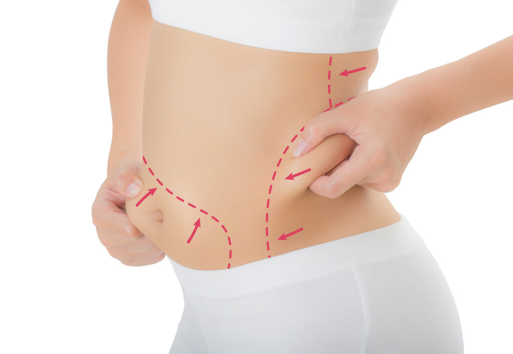 Lipo Dubai: What to Expect Before, During, and After Your Procedure