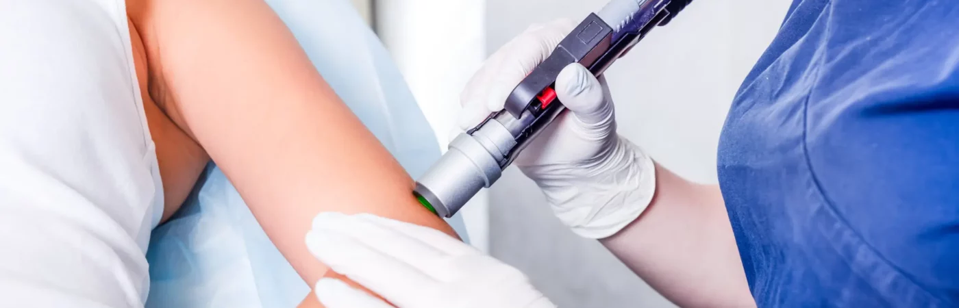 Laser Hair Removal in Brighton