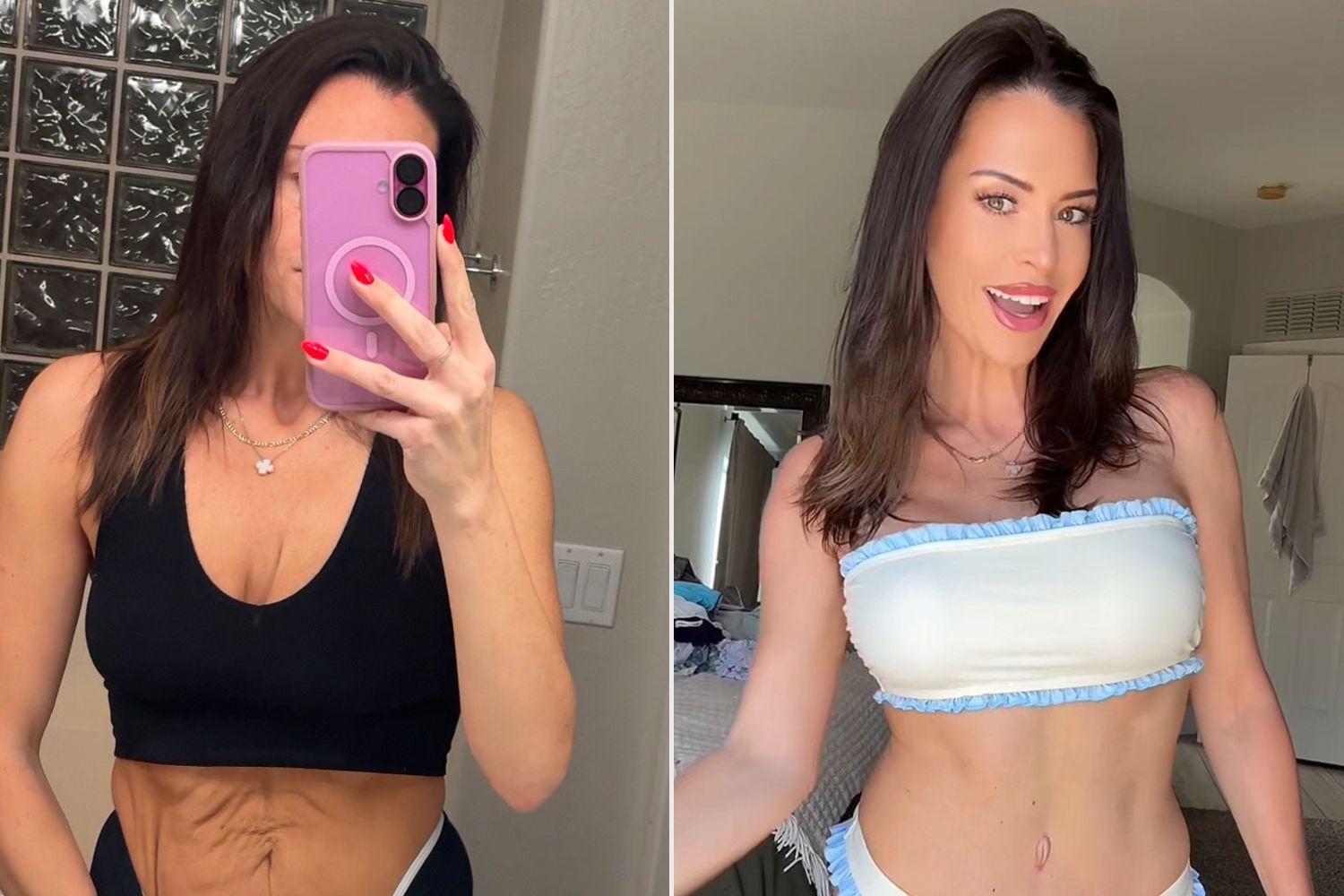 How Much Does a Mommy Makeover Cost in Mexico?